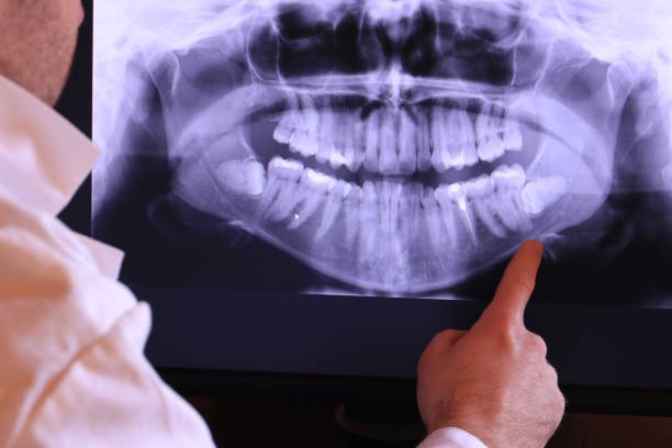 Best Emergency Treatment for Oral Infections in Plover, WI